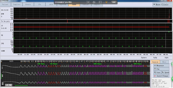 Stable Multi Function Holter ECG Software For Heart Rate Turbulence Recorder
