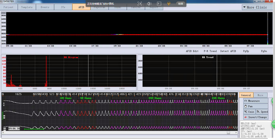 Stable Multi Function Holter ECG Software For Heart Rate Turbulence Recorder