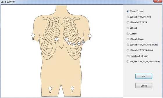 Portable PC Based ECG With USB ECG for PC WINDOWS CV200