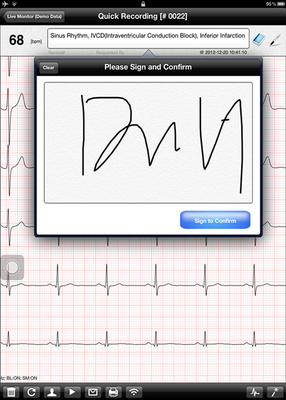 electrocardiogram test wifi ipad ECG recorder , Pocket ecg machine