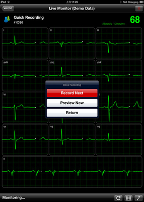 electrocardiogram test wifi ipad ECG recorder , Pocket ecg machine