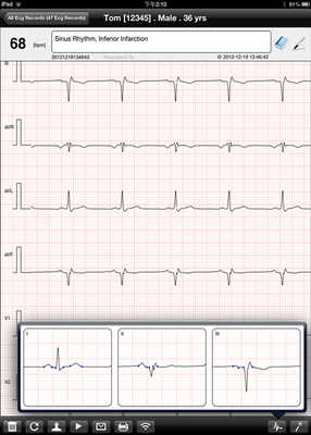 electrocardiogram test wifi ipad ECG recorder , Pocket ecg machine