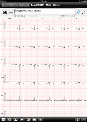 electrocardiogram test wifi ipad ECG recorder , Pocket ecg machine