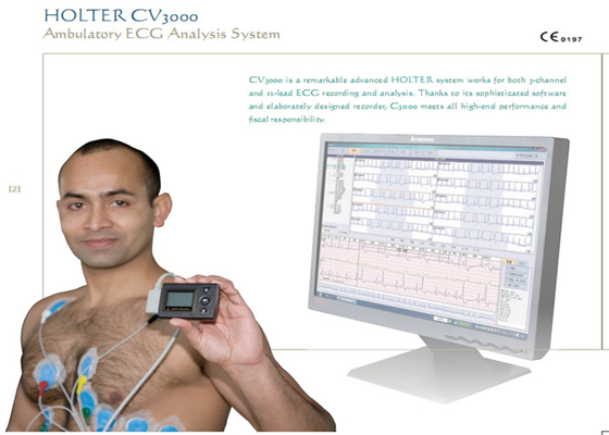 Exercise Electrocardiogram ECG