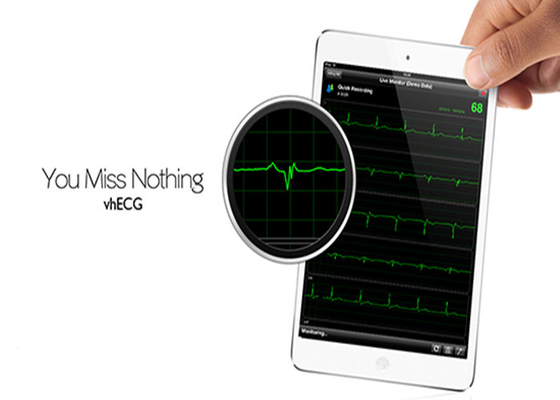 electrocardiogram test wifi ipad ECG recorder , Pocket ecg machine
