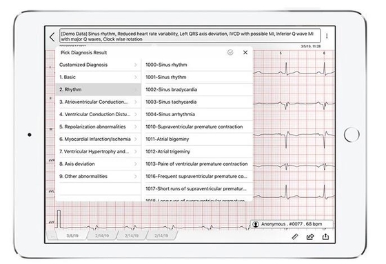 2 AA Batteries Power Wireless ECG Machine 0.4uV Resolution With FDA Approved